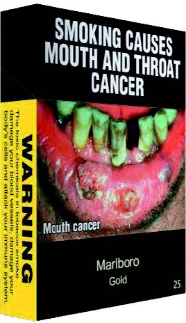 mouth-throat-cancer.jpg